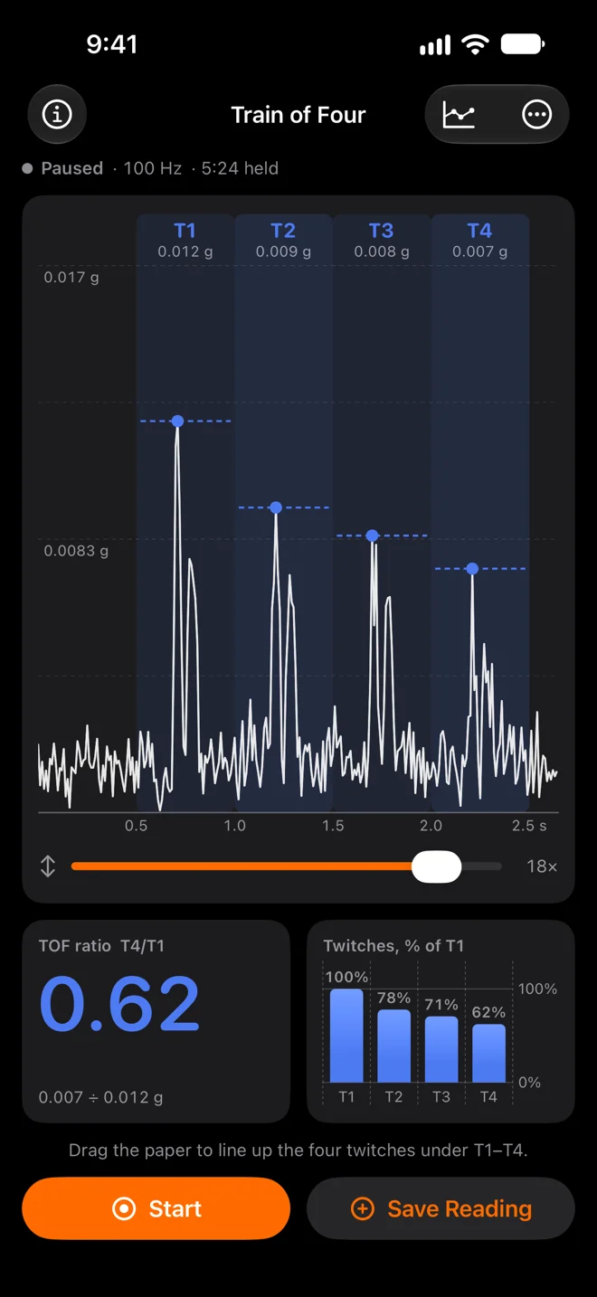 Train of Four paused on a train: four fading twitches under the columns T1 to T4, each peak marked, T4/T1 0.62 and the twitches as bars